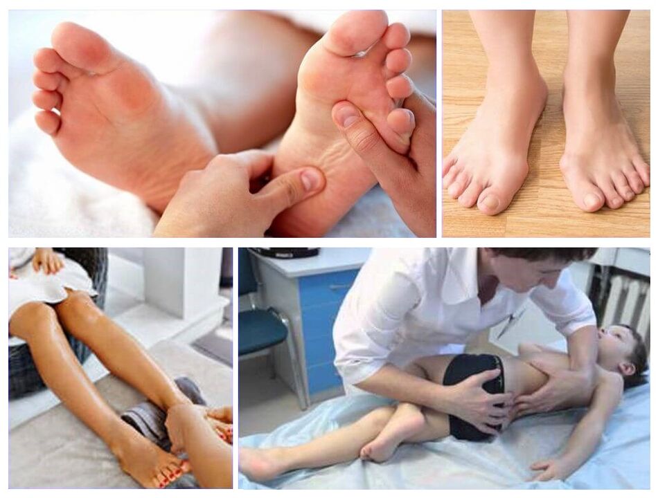 Deformação de Valgus no tratamento infantil