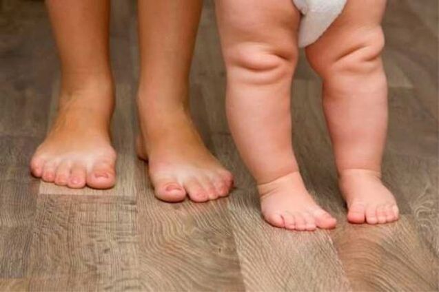 Deformação de Valgus