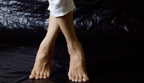 Deformação de Valgus