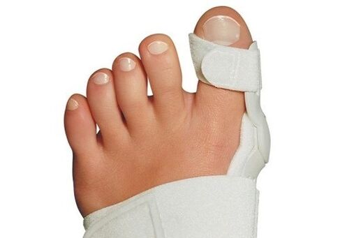 Deformação de Valgus